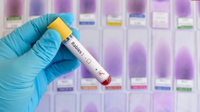 Bệnh dại có xét nghiệm được không? Các loại xét nghiệm bệnh dại hiện nay